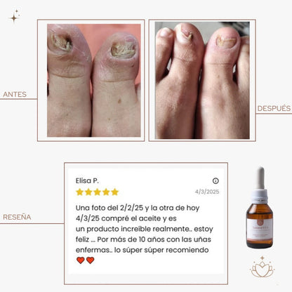 ACEITE ANTIFUNGICO PARA PIES