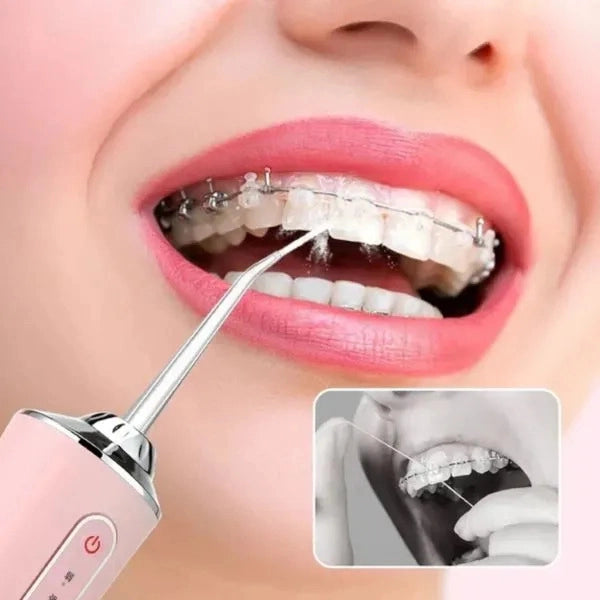 IRRIGADOR ORAL RECARGABLE